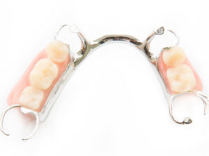 Günstiger Zahnersatz - Zahnprothesen-Beispiel 2