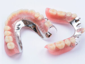 Günstiger Zahnersatz - Zahnprothesen-Beispiel 4