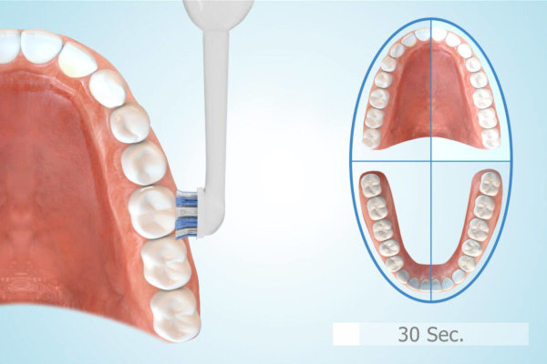 Zähne putzen mit elektrischer Zahnbürste
